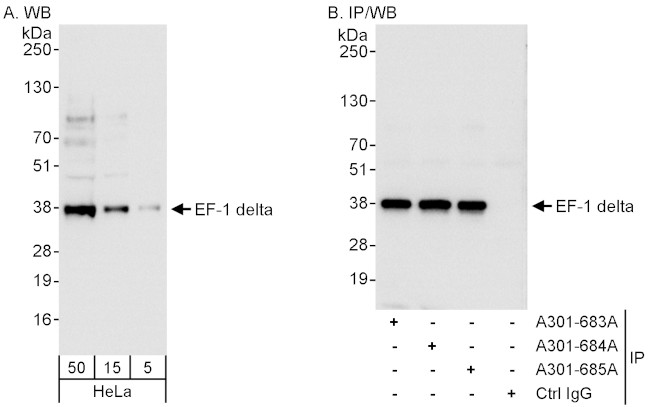 EF-1 delta Antibody in Western Blot (WB)