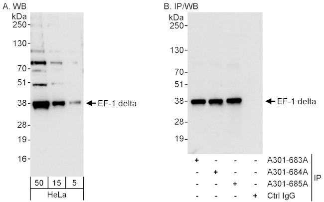 EF-1 delta Antibody in Western Blot (WB)