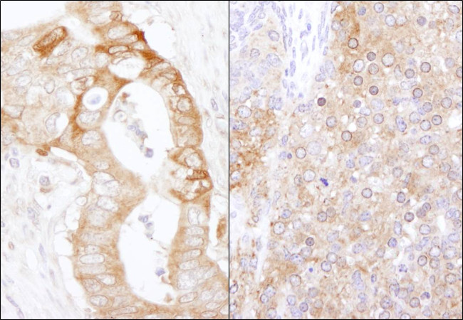 eEF2 Kinase Antibody in Immunohistochemistry (Paraffin) (IHC (P))