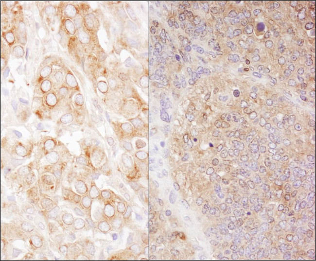 eEF2 Antibody in Immunohistochemistry (Paraffin) (IHC (P))