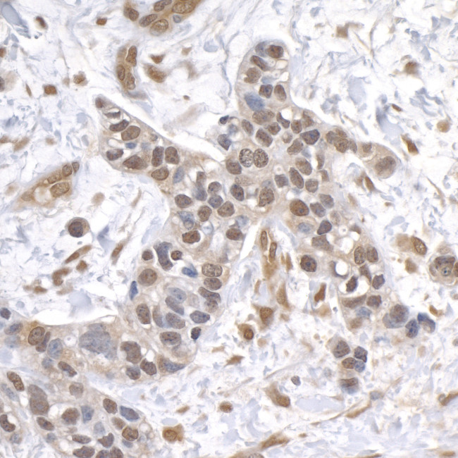 USP1 Antibody in Immunohistochemistry (Paraffin) (IHC (P))