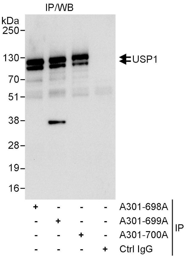 USP1 Antibody in Immunoprecipitation (IP)