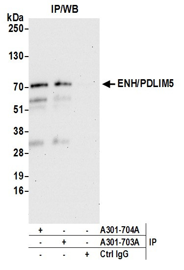 ENH/PDLIM5 Antibody in Immunoprecipitation (IP)