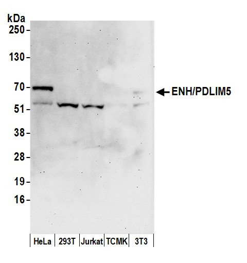 ENH/PDLIM5 Antibody in Western Blot (WB)
