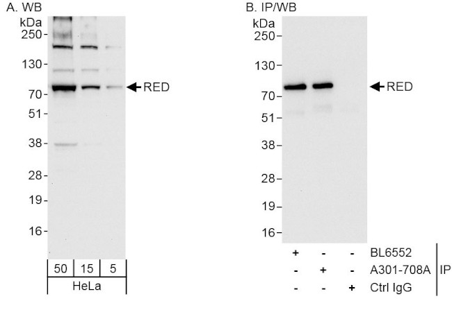 RED Antibody in Western Blot (WB)