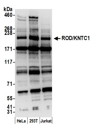 ROD/KNTC1 Antibody in Western Blot (WB)