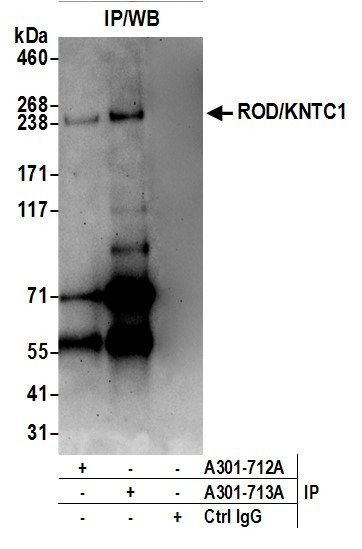 ROD/KNTC1 Antibody in Immunoprecipitation (IP)
