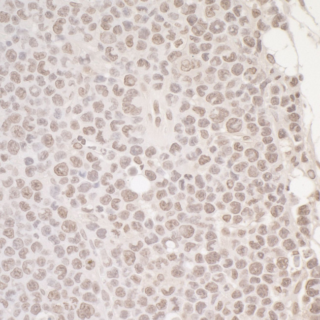 OCT1 Antibody in Immunohistochemistry (Paraffin) (IHC (P))