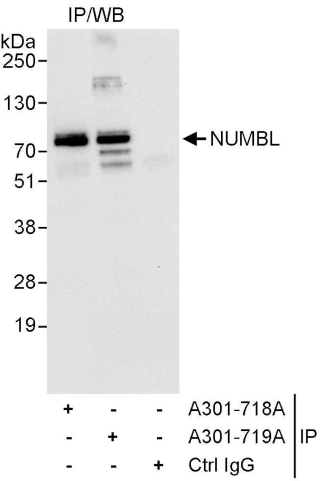 NUMBL Antibody in Immunoprecipitation (IP)