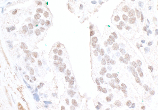 FBW7 Antibody in Immunohistochemistry (Paraffin) (IHC (P))