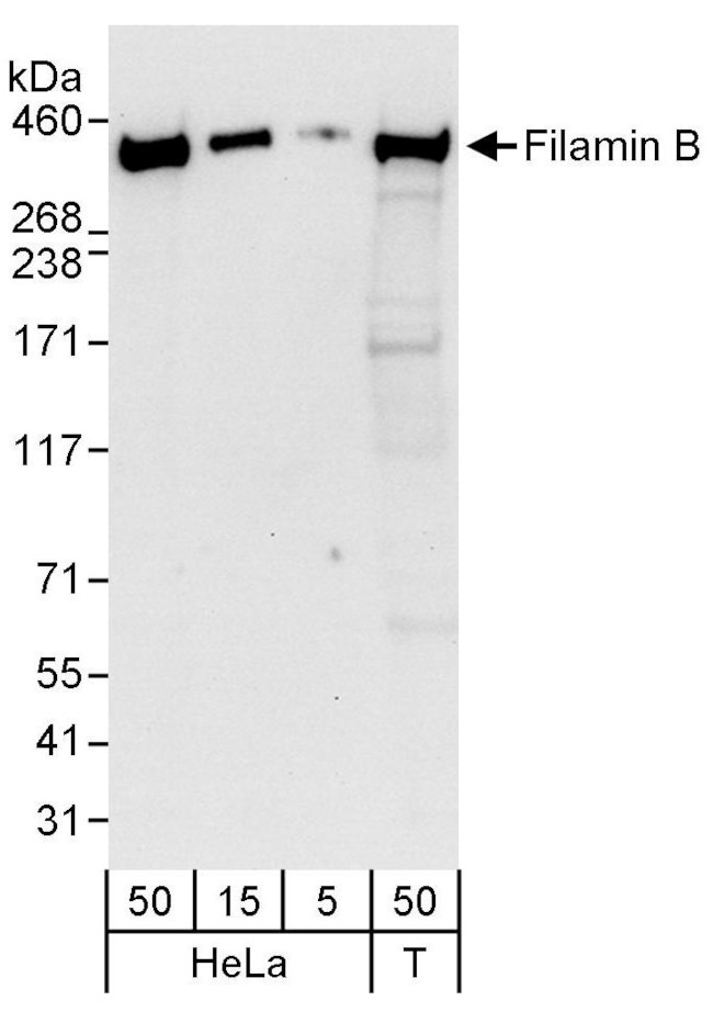 Filamin B Antibody in Western Blot (WB)