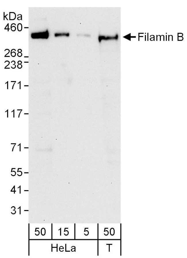 Filamin B Antibody in Western Blot (WB)
