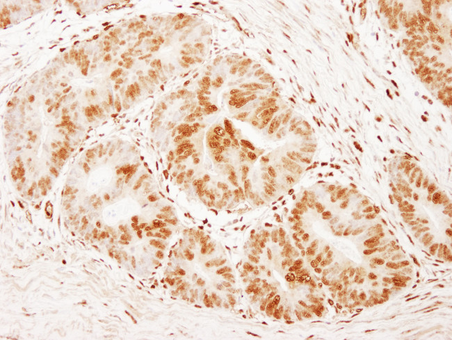 FOXK1 Antibody in Immunohistochemistry (Paraffin) (IHC (P))