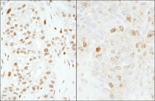 FOXK1 Antibody in Immunohistochemistry (Paraffin) (IHC (P))