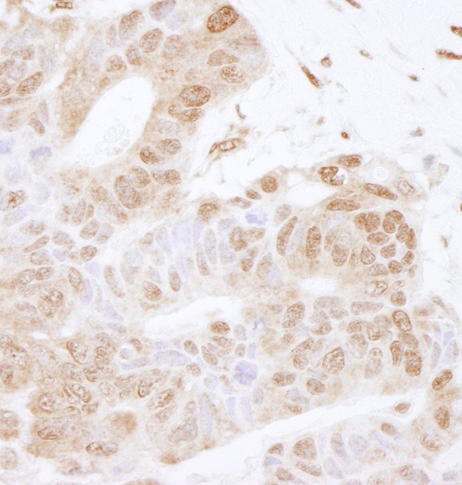 FOXK2 Antibody in Immunohistochemistry (Paraffin) (IHC (P))