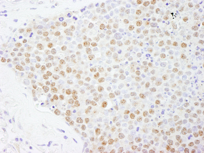 FOXK2 Antibody in Immunohistochemistry (Paraffin) (IHC (P))
