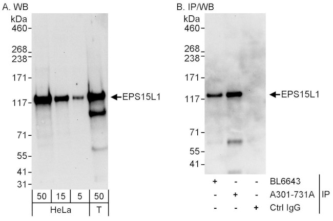 EPS15L Antibody in Western Blot (WB)