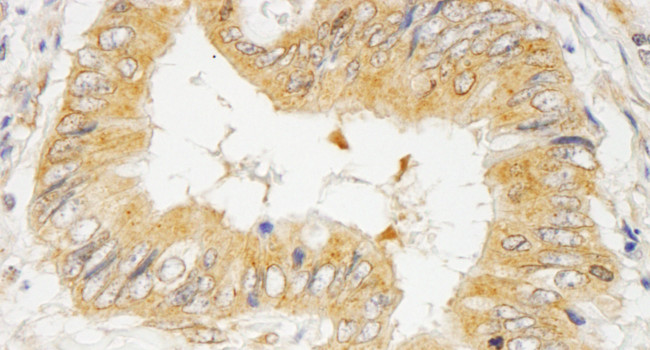 GRB10 Antibody in Immunohistochemistry (Paraffin) (IHC (P))