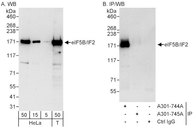 eIF5B/IF2 Antibody in Western Blot (WB)
