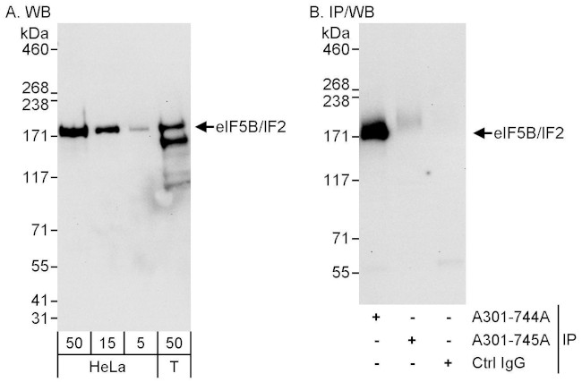 eIF5B/IF2 Antibody in Western Blot (WB)