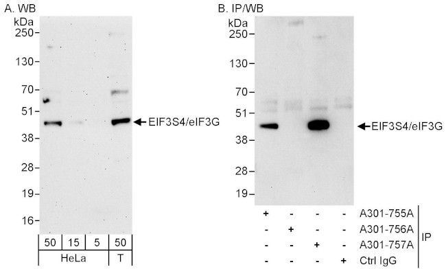 eIF3G/EIF3S4 Antibody in Western Blot (WB)
