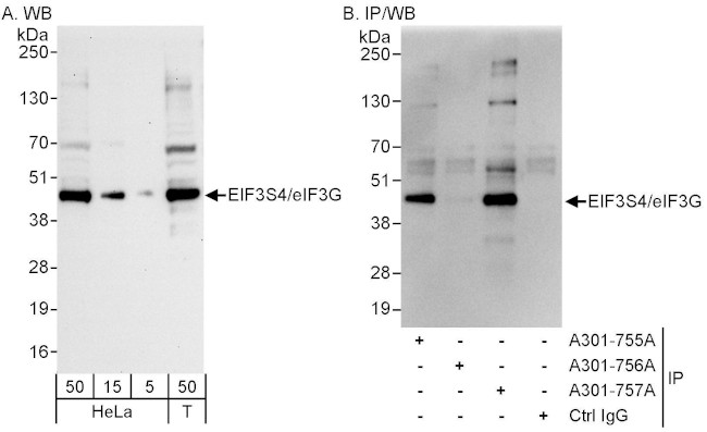 eIF3G/EIF3S4 Antibody in Western Blot (WB)