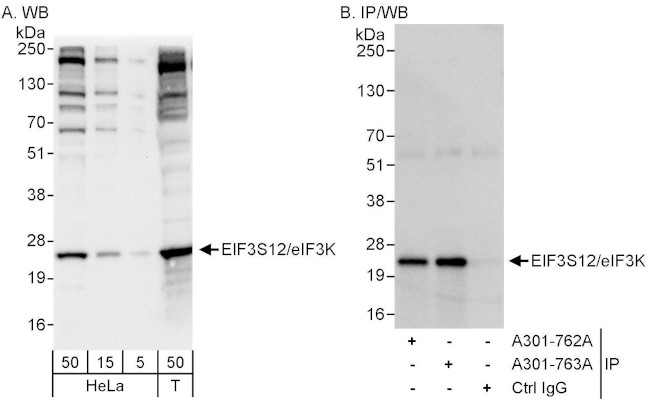 eIF3K/EIF3S12 Antibody in Western Blot (WB)