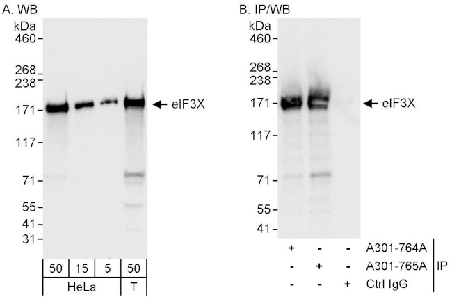 eIF3X Antibody in Western Blot (WB)