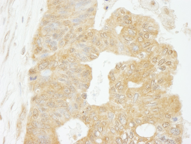 eIF4G1/eIF4GI Antibody in Immunohistochemistry (Paraffin) (IHC (P))