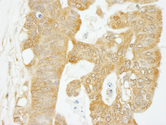 eIF4G1/eIF4GI Antibody in Immunohistochemistry (Paraffin) (IHC (P))