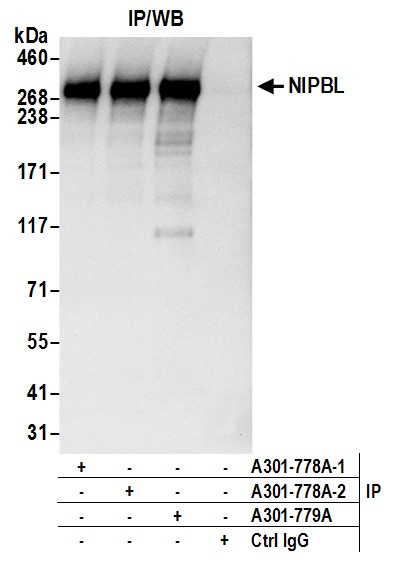 NIPBL Antibody in Immunoprecipitation (IP)