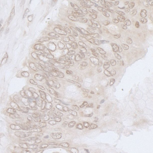 NUP35 Antibody in Immunohistochemistry (Paraffin) (IHC (P))