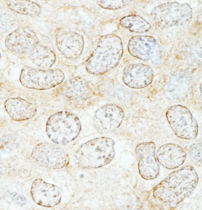 NUP50 Antibody in Immunohistochemistry (Paraffin) (IHC (P))