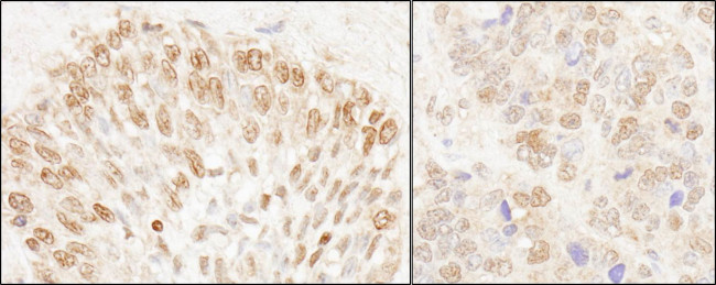 NUP50 Antibody in Immunohistochemistry (Paraffin) (IHC (P))