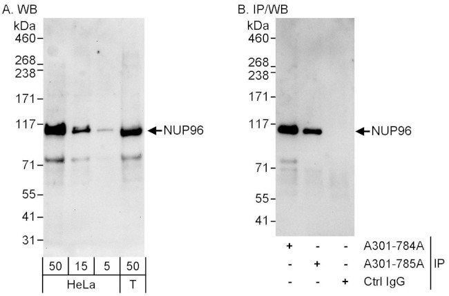 NUP96 Antibody in Western Blot (WB)