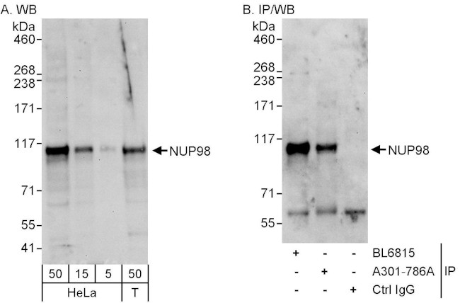 NUP98 Antibody in Western Blot (WB)