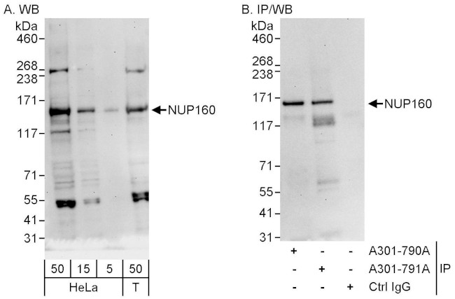 NUP160 Antibody in Western Blot (WB)