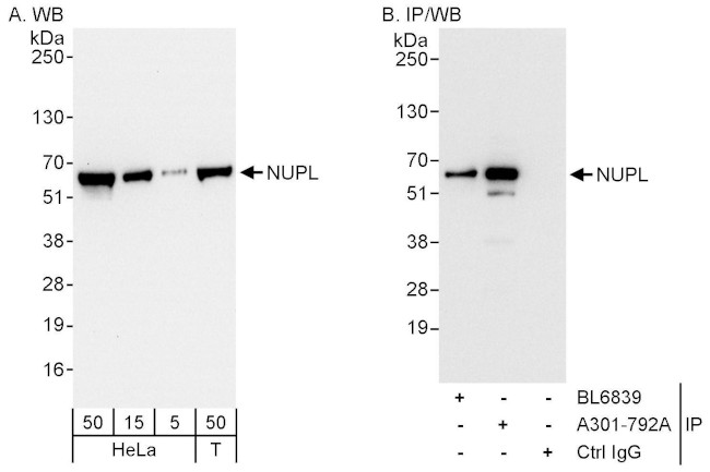 NUPL Antibody in Western Blot (WB)