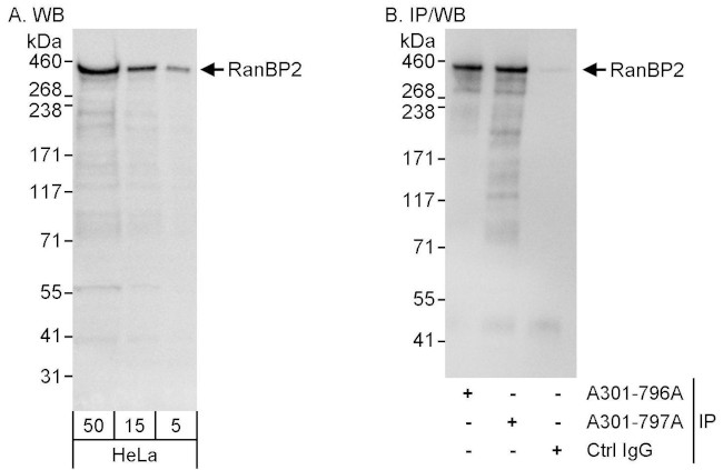 RanBP2 Antibody in Western Blot (WB)