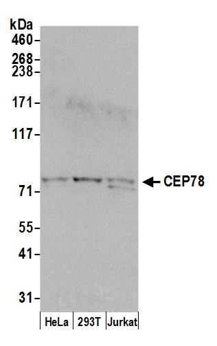 CEP78 Antibody in Western Blot (WB)
