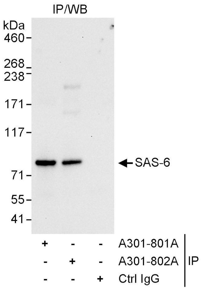 SAS-6 Antibody in Immunoprecipitation (IP)