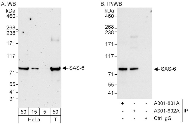 SAS-6 Antibody in Western Blot (WB)