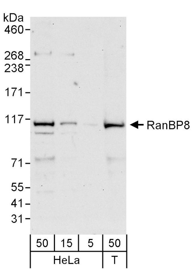 RanBP8 Antibody in Western Blot (WB)