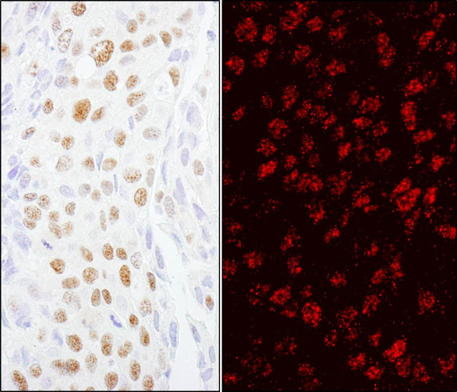 ZCCHC8 Antibody in Immunohistochemistry (Paraffin) (IHC (P))