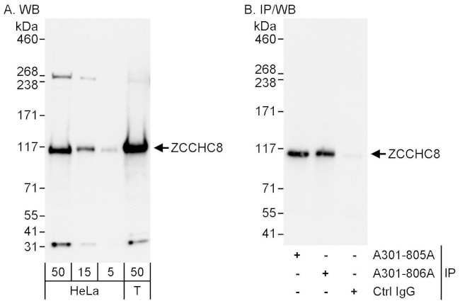 ZCCHC8 Antibody in Western Blot (WB)