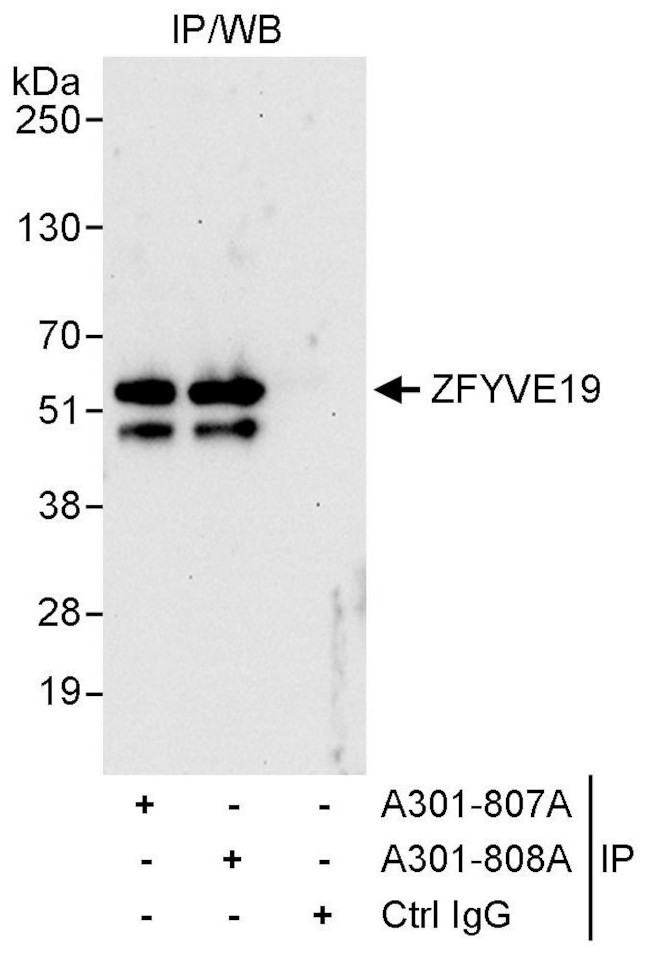 ZFYVE19 Antibody in Immunoprecipitation (IP)