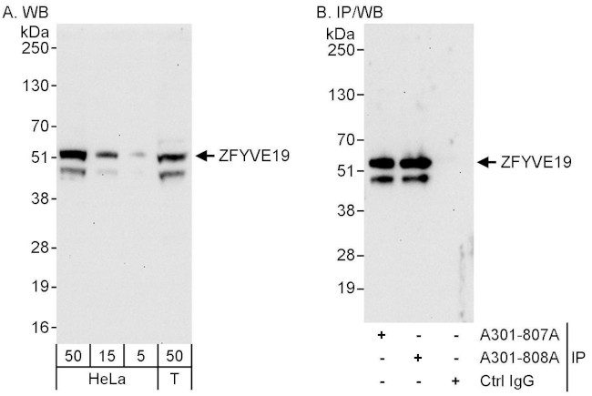 ZFYVE19 Antibody in Western Blot (WB)
