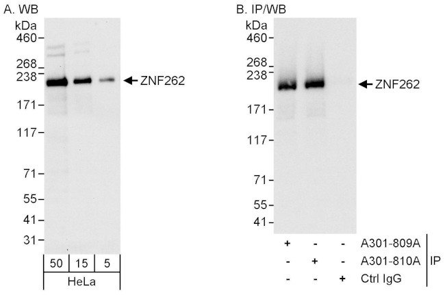 ZNF262 Antibody in Western Blot (WB)