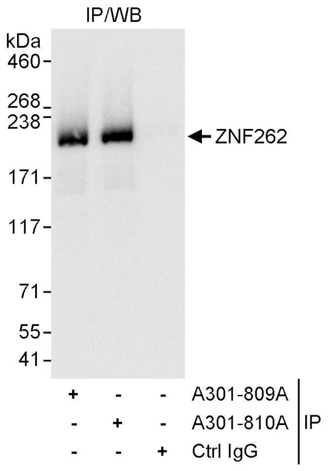 ZNF262 Antibody in Immunoprecipitation (IP)