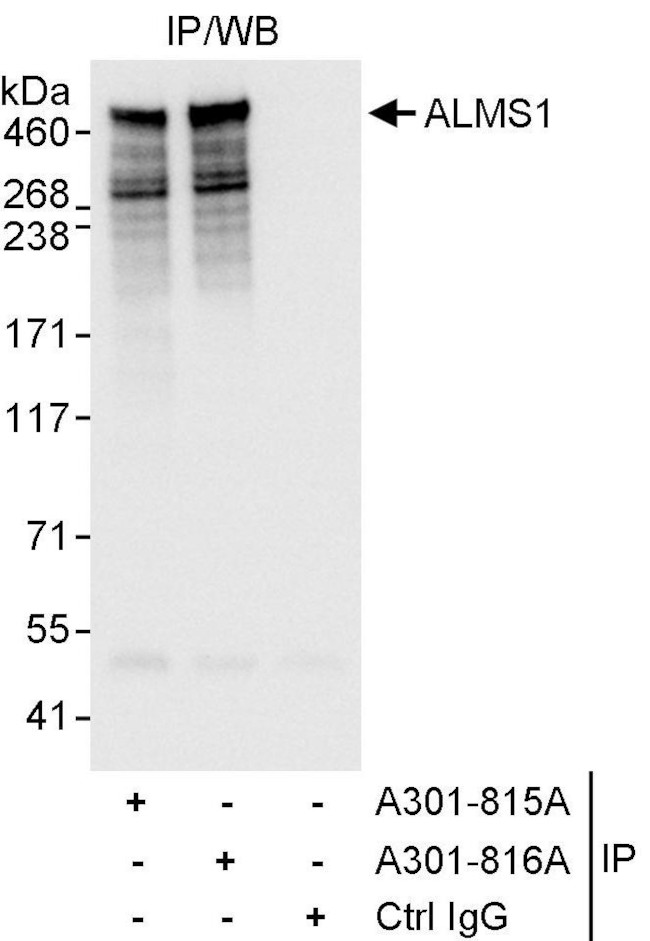 ALMS1 Antibody in Immunoprecipitation (IP)